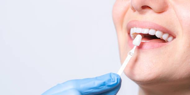 dental implant clinic in greater noida