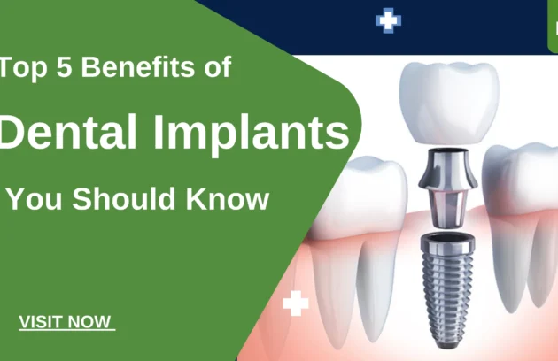 dental implants in Greater Noida